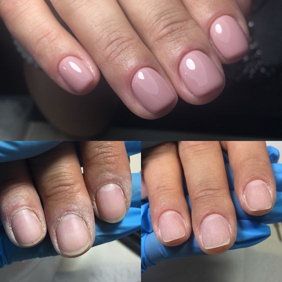 antes e depois de unhas feitas por uma manicure rápida